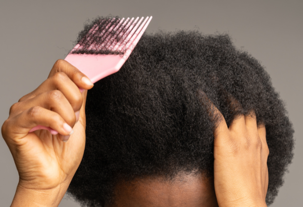 Black woman losing her hair